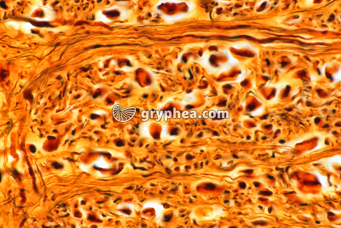 Moelle épinière substance blanche x160 - gryphea.com